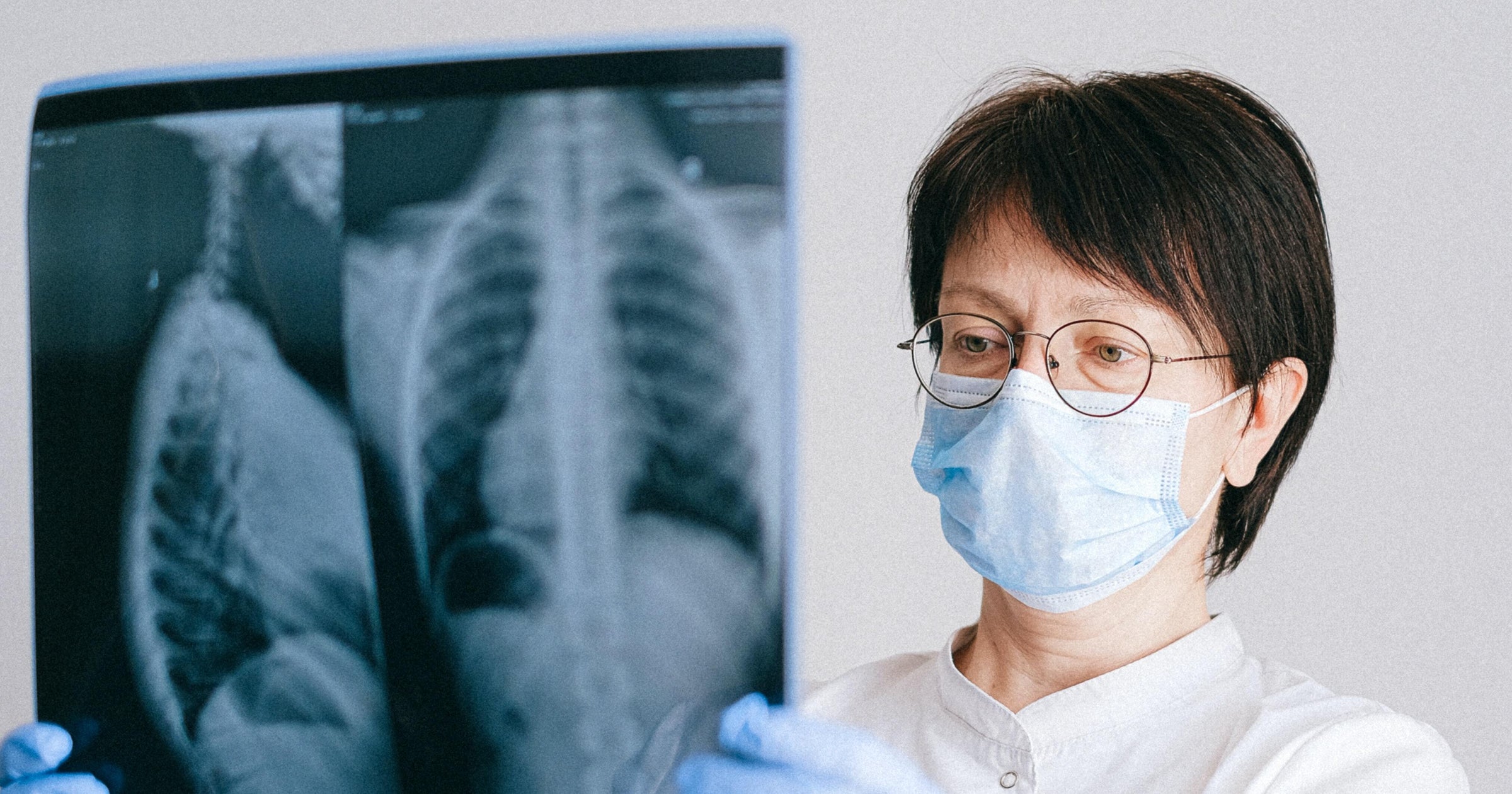 pulmonologist interview questions