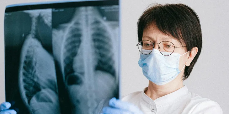 A doctor holding X-rays.