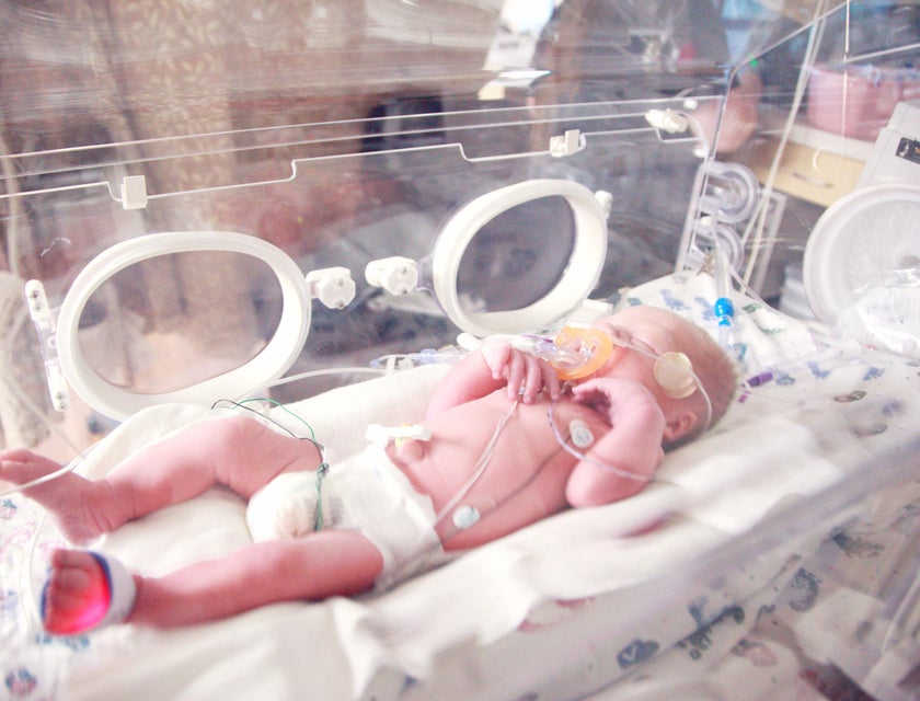 A newborn baby lying in a neonatal intensive care unit.
