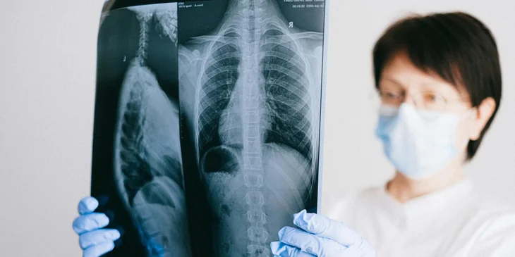 Doctora sosteniendo una radiografía del sistema respiratorio.