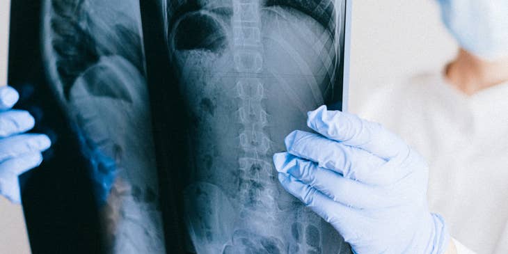 Doctora sosteniendo una radiografía del sistema respiratorio.