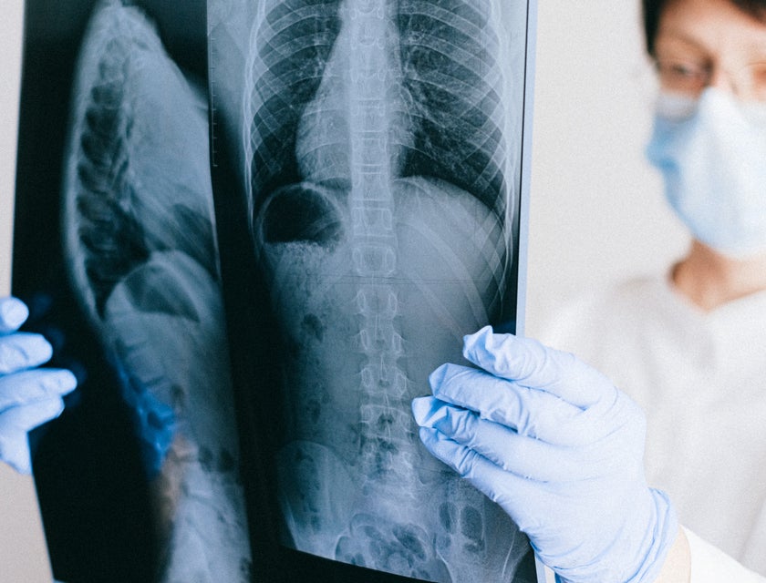 Doctora sosteniendo una radiografía del sistema respiratorio.
