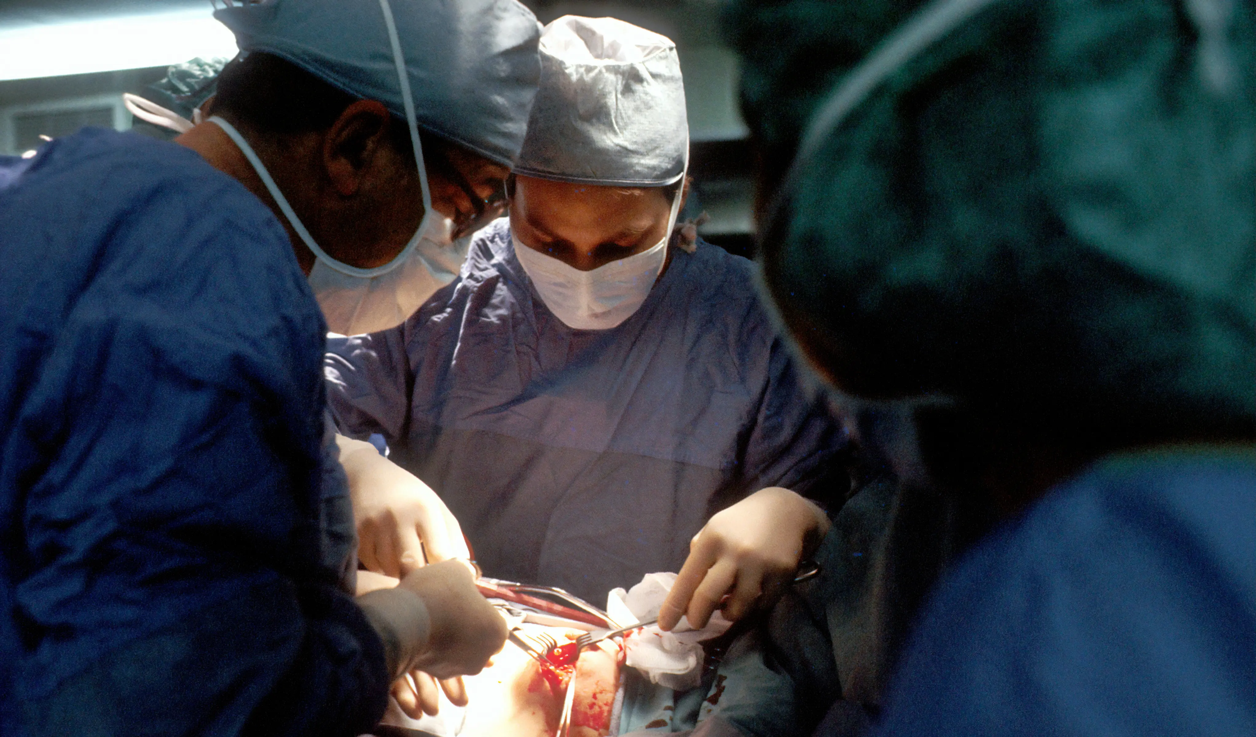 Cardiothoracic Surgeon Interview Questions