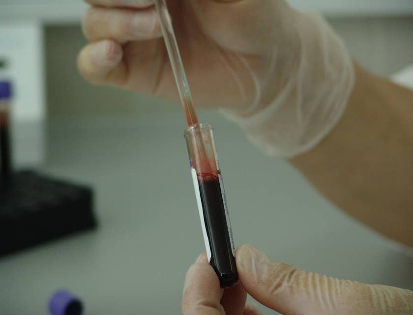 A Forensic Science Technician preparing to perform tests on a collected blood sample evidence from a crime scene.