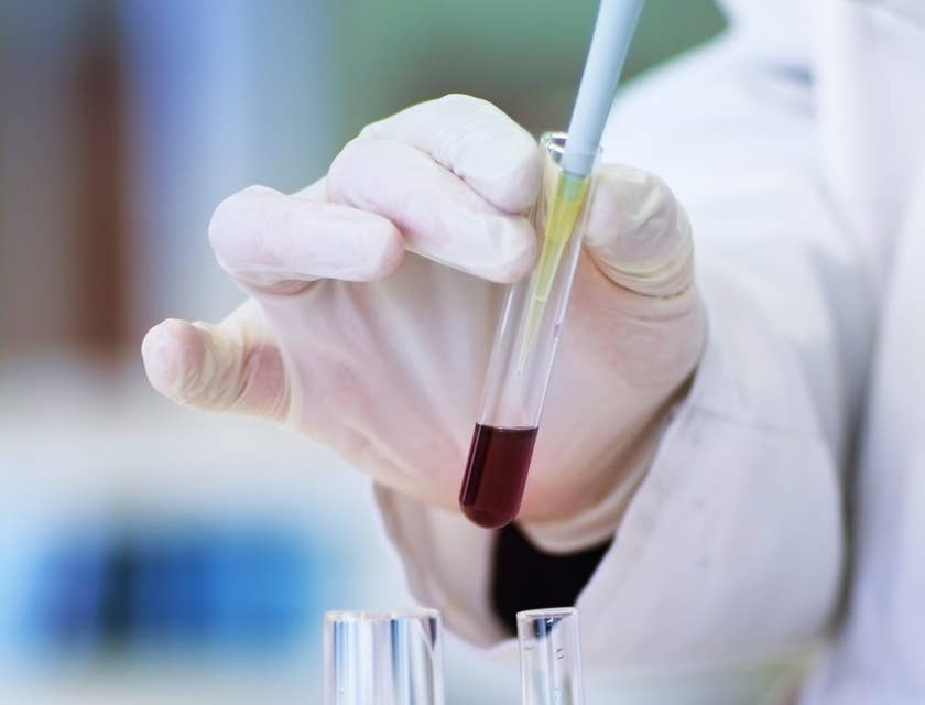 Hematologist analyzing a blood sample.