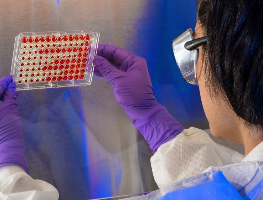 Immunologist examining a microtiter plate in a laboratory.