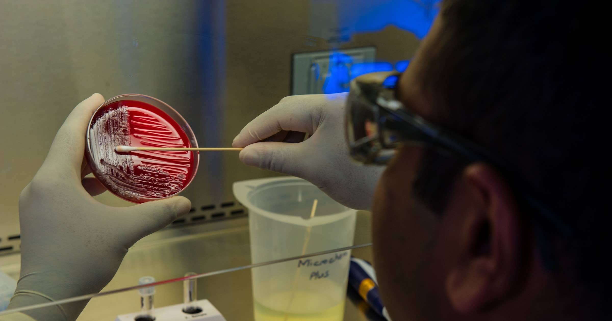 Microbiologist Interview Questions