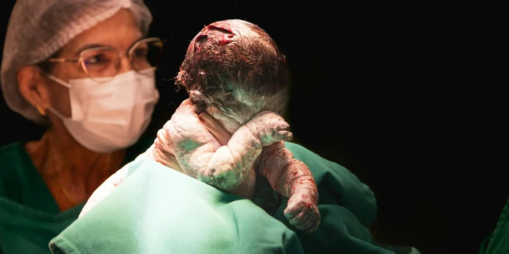 A midwife assisting with childbirth in a hospital setting.