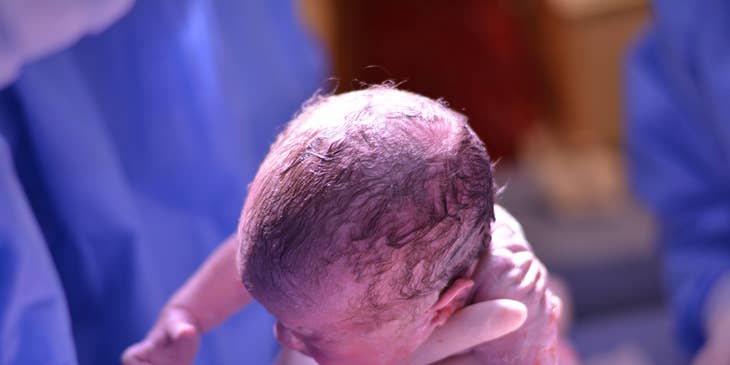 Midwife assists with childbirth in a hospital setting.