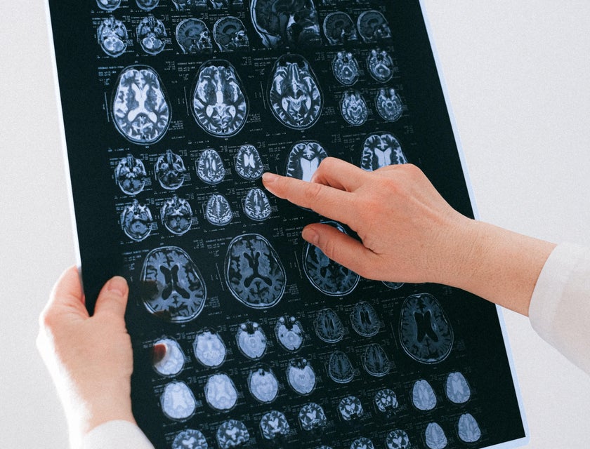 Neurologist interprets the results of neuroimaging.